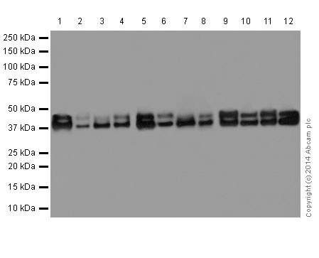 Western blot - Anti-ERK1 + ERK2 antibody [EPR17526] (AB184699), expandable thumbnail