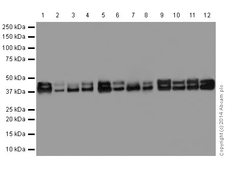 Western blot - Anti-ERK1 + ERK2 antibody [EPR17526] (AB184699)