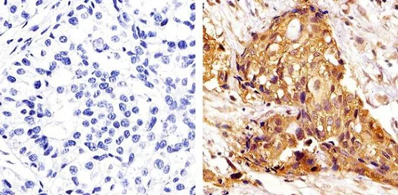 Immunohistochemistry (Formalin/PFA-fixed paraffin-embedded sections) - Anti-ERK1 + ERK2 antibody [ERK-7D8] (AB54230)