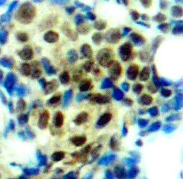 Immunohistochemistry (Formalin/PFA-fixed paraffin-embedded sections) - Anti-ERK1 (phospho T202) antibody (AB194776)