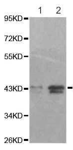 Western blot - Anti-ERK1 (phospho T202) antibody (AB194776)