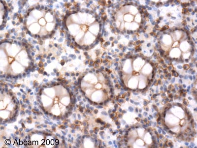 Immunohistochemistry (Formalin/PFA-fixed paraffin-embedded sections) - Anti-ERK1 (phospho T202) antibody (AB47310)