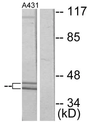Western blot - Anti-ERK1 (phospho T202) antibody (AB47310)