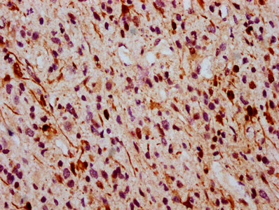 Immunohistochemistry (Formalin/PFA-fixed paraffin-embedded sections) - Anti-ERK1 (phospho T202) + ERK2 (phospho T185) antibody [2D5] (AB314200), expandable thumbnail