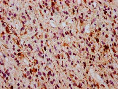 Immunohistochemistry (Formalin/PFA-fixed paraffin-embedded sections) - Anti-ERK1 (phospho T202) + ERK2 (phospho T185) antibody [2D5] (AB314200)