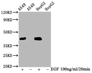 Western blot - Anti-ERK1 (phospho T202) + ERK2 (phospho T185) antibody [2D5] (AB314200)