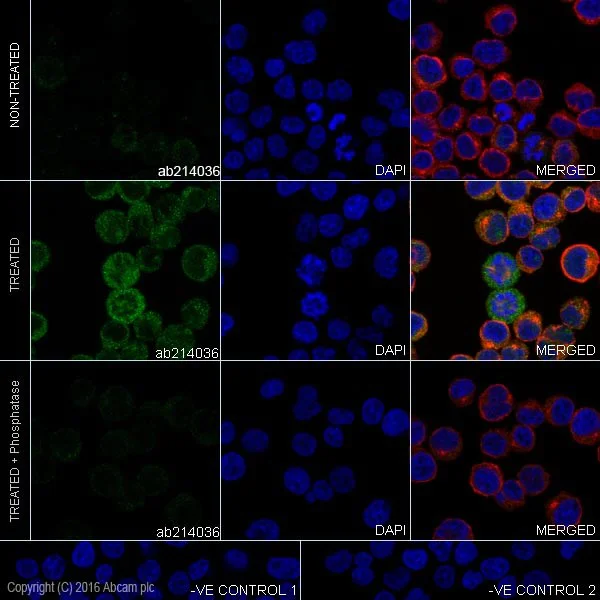 Immunocytochemistry/ Immunofluorescence - Anti-ERK1 (phospho T202) + ERK2 (phospho T185) antibody [EPR18444] (AB214036)