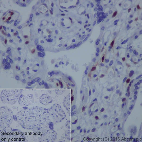 Immunohistochemistry (Formalin/PFA-fixed paraffin-embedded sections) - Anti-ERK1 (phospho T202) + ERK2 (phospho T185) antibody [EPR18444] (AB214036)