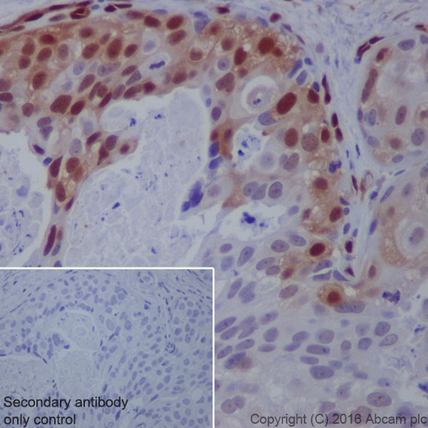 Immunohistochemistry (Formalin/PFA-fixed paraffin-embedded sections) - Anti-ERK1 (phospho T202) + ERK2 (phospho T185) antibody [EPR18444] (AB214036)