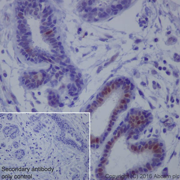 Anti-ERK1 (phospho T202) + ERK2 (phospho T185) antibody [EPR18444