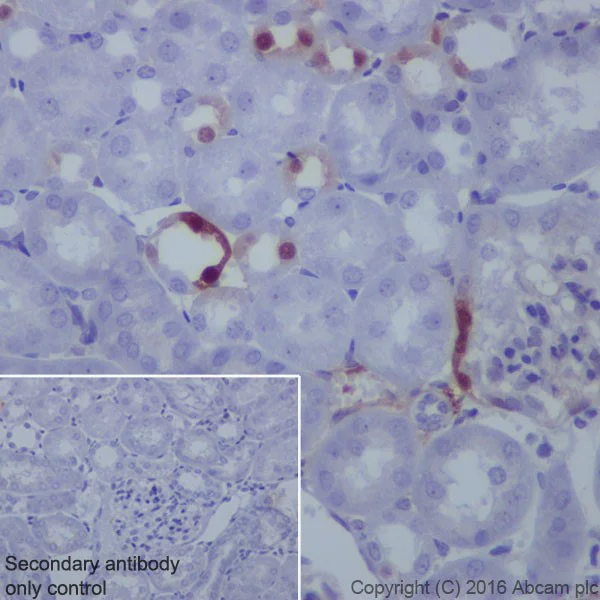 Immunohistochemistry (Formalin/PFA-fixed paraffin-embedded sections) - Anti-ERK1 (phospho T202) + ERK2 (phospho T185) antibody [EPR18444] - BSA and Azide free (AB222493)