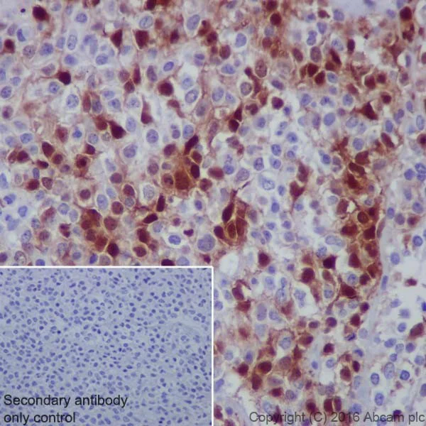 Immunohistochemistry (Formalin/PFA-fixed paraffin-embedded sections) - Anti-ERK1 (phospho T202) + ERK2 (phospho T185) antibody [EPR18444] - BSA and Azide free (AB222493)