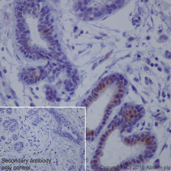 Immunohistochemistry (Formalin/PFA-fixed paraffin-embedded sections) - Anti-ERK1 (phospho T202) + ERK2 (phospho T185) antibody [EPR18444] - BSA and Azide free (AB222493)