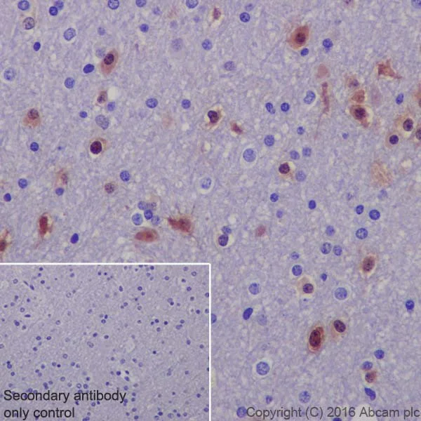 Immunohistochemistry (Formalin/PFA-fixed paraffin-embedded sections) - Anti-ERK1 (phospho T202) + ERK2 (phospho T185) antibody [EPR19401] (AB201015)