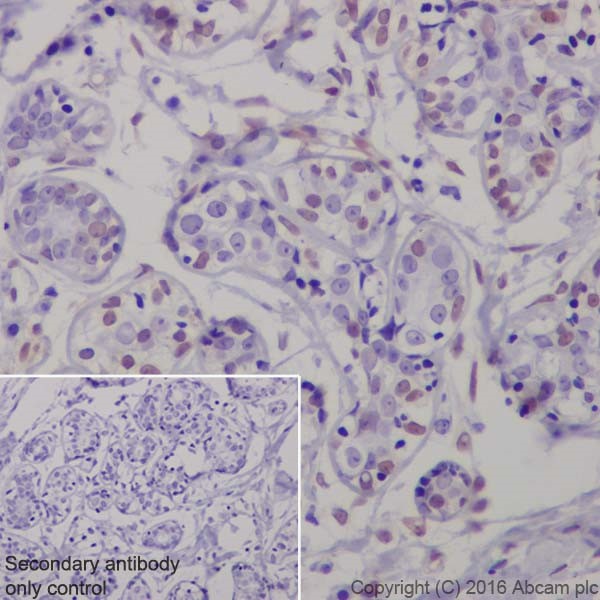 Anti-ERK1 (phospho T202) + ERK2 (phospho T185) antibody