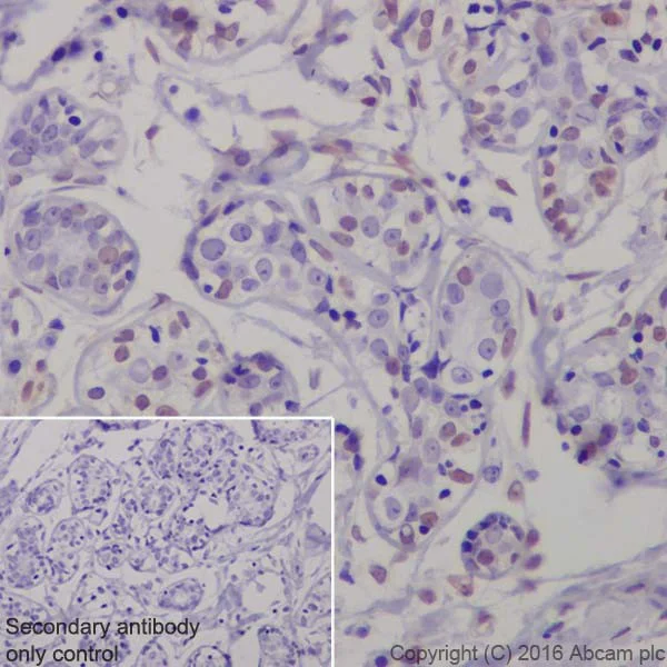 Immunohistochemistry (Formalin/PFA-fixed paraffin-embedded sections) - Anti-ERK1 (phospho T202) + ERK2 (phospho T185) antibody [EPR19401] (AB201015)