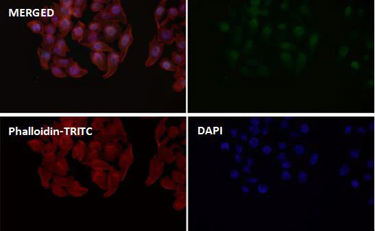 Immunocytochemistry/ Immunofluorescence - Anti-ERK1 (phospho T202) + ERK2 (phospho T185) antibody [SZ2-4] (AB326616)