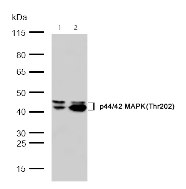 Western blot - Anti-ERK1 (phospho T202) + ERK2 (phospho T185) antibody [SZ2-4] (AB326616)