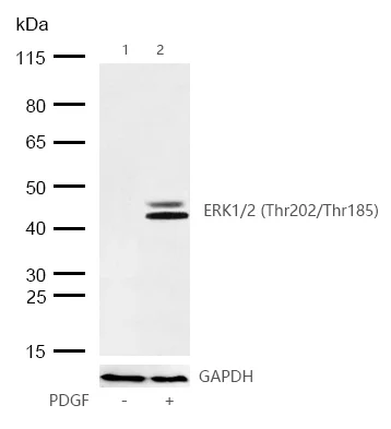 Western blot - Anti-ERK1 (phospho T202) + ERK2 (phospho T185) antibody [SZ2-4] (AB326616)