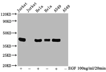Western blot - Anti-ERK1 (phospho T202 + T204) + ERK2 (phospho T185 + T187) antibody [4F6] (AB314199)
