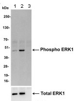 Immunoprecipitation - Anti-ERK1 (phospho T202 + Y204) + ERK2 (phospho T185 + Y187) antibody (AB128159)