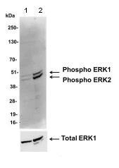 Western blot - Anti-ERK1 (phospho T202 + Y204) + ERK2 (phospho T185 + Y187) antibody (AB128159)