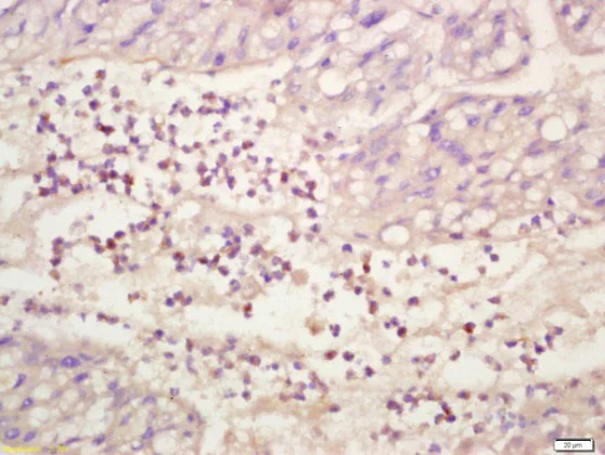 Immunohistochemistry (Formalin/PFA-fixed paraffin-embedded sections) - Anti-ERK1 (phospho T202 + Y204) + ERK2 (phospho T185 + Y187) antibody (AB214362)