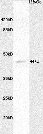 Western blot - Anti-ERK1 (phospho T202 + Y204) + ERK2 (phospho T185 + Y187) antibody (AB214362)