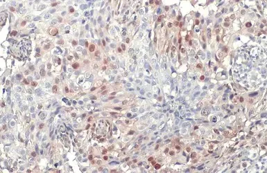 Immunohistochemistry (Formalin/PFA-fixed paraffin-embedded sections) - Anti-ERK1 (phospho T202 + Y204) + ERK2 (phospho T185 + Y187) antibody [HL173] - BSA and Azide free (AB289367)