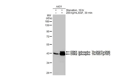 Western blot - Anti-ERK1 (phospho T202 + Y204) + ERK2 (phospho T185 + Y187) antibody [HL173] - BSA and Azide free (AB289367)