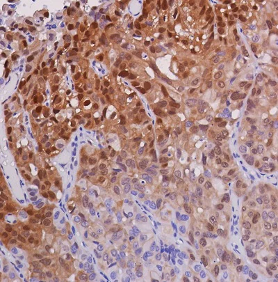 Immunohistochemistry (Formalin/PFA-fixed paraffin-embedded sections) - Anti-ERK1 (phospho T202 + Y204) + ERK2 (phospho T185 + Y187) antibody [SP327] (AB223500)