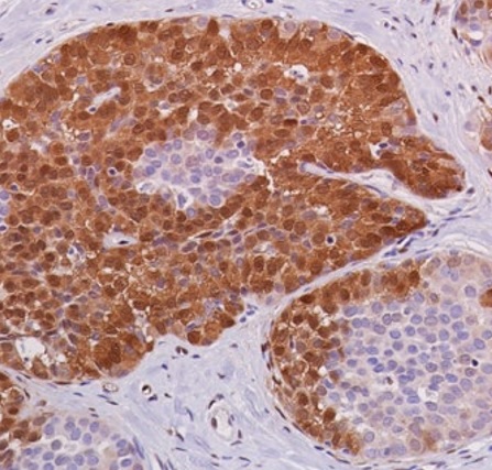 Anti-ERK1 (phospho T202 + Y204) + ERK2 (phospho T185 + Y187