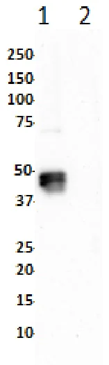 Western blot - Anti-ERK1 (phospho T202 + Y204) + ERK2 (phospho T185 + Y187) antibody [SP327] (AB223500)