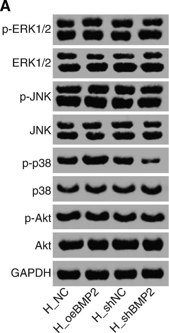 E.R.Kページ Anti-ERK1 (phospho T202 + Y204) + ERK2 (phospho T185 + Y187
