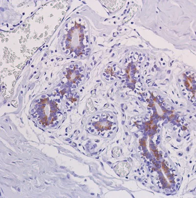 Immunohistochemistry (Formalin/PFA-fixed paraffin-embedded sections) - Anti-ERK1 (phospho T202 + Y204) + ERK2 (phospho T185 + Y187) antibody [SP327] - BSA and Azide free (AB242418)