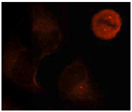 Immunocytochemistry/ Immunofluorescence - Anti-ERK1 (phospho Y204) antibody (AB131438)