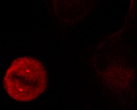 Immunocytochemistry/ Immunofluorescence - Anti-ERK1 (phospho Y204) antibody (AB194770), expandable thumbnail