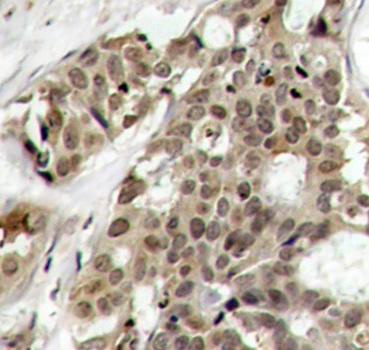 Immunohistochemistry (Formalin/PFA-fixed paraffin-embedded sections) - Anti-ERK1 (phospho Y204) antibody (AB194770), expandable thumbnail