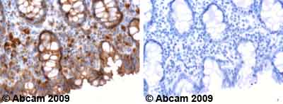 Immunohistochemistry (Formalin/PFA-fixed paraffin-embedded sections) - Anti-ERK1 (phospho Y204) + ERK2 (phospho Y187) antibody (AB47339)