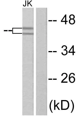 Western blot - Anti-ERK1 (phospho Y204) + ERK2 (phospho Y187) antibody (AB47339)