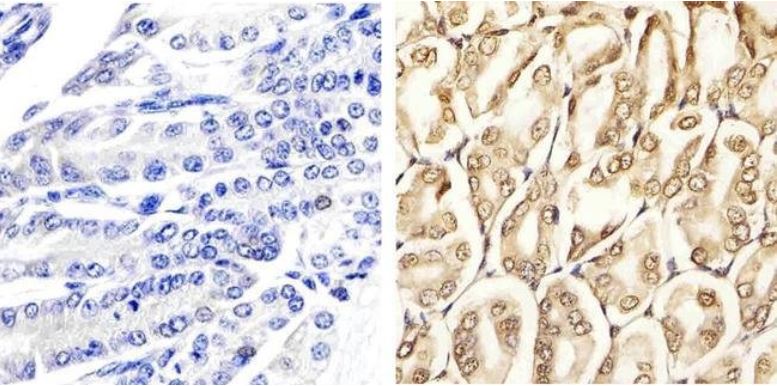 Immunohistochemistry (Formalin/PFA-fixed paraffin-embedded sections) - Anti-Erk1 (pT202/pY204) + Erk2 (pT185/pY187) antibody (AB4819), expandable thumbnail