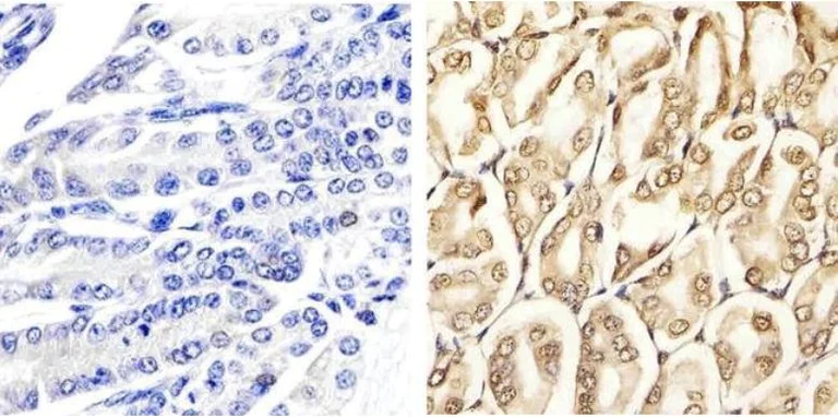 Immunohistochemistry (Formalin/PFA-fixed paraffin-embedded sections) - Anti-Erk1 (pT202/pY204) + Erk2 (pT185/pY187) antibody (AB4819)