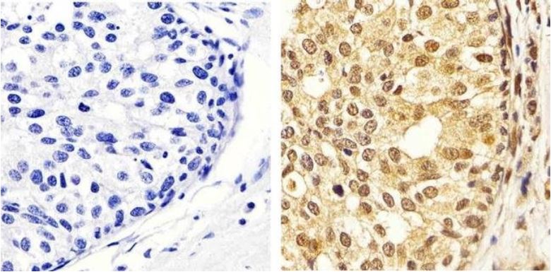 Immunohistochemistry (Formalin/PFA-fixed paraffin-embedded sections) - Anti-Erk1 (pT202/pY204) + Erk2 (pT185/pY187) antibody (AB4819), expandable thumbnail