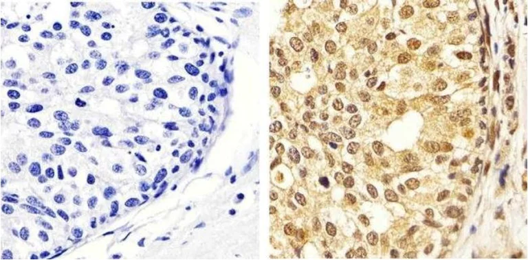 Anti-Erk1 (pT202/pY204) + Erk2 (pT185/pY187) antibody (ab4819) | Abcam