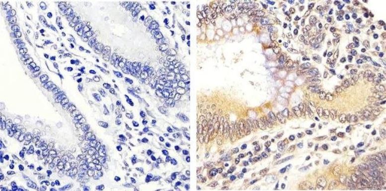 Immunohistochemistry (Formalin/PFA-fixed paraffin-embedded sections) - Anti-Erk1 (pT202/pY204) + Erk2 (pT185/pY187) antibody (AB4819), expandable thumbnail