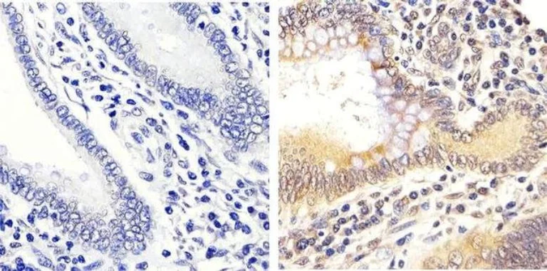 Immunohistochemistry (Formalin/PFA-fixed paraffin-embedded sections) - Anti-Erk1 (pT202/pY204) + Erk2 (pT185/pY187) antibody (AB4819)