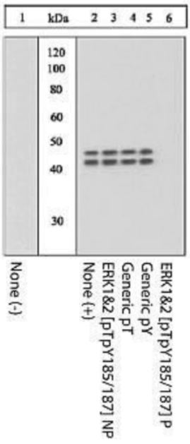 Western blot - Anti-Erk1 (pT202/pY204) + Erk2 (pT185/pY187) antibody (AB4819), expandable thumbnail