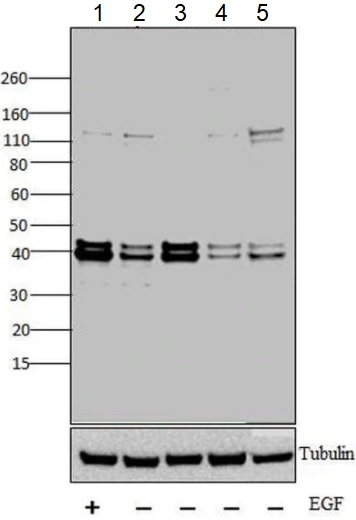 Western blot - Anti-Erk1 (pT202/pY204) + Erk2 (pT185/pY187) antibody (AB4819), expandable thumbnail