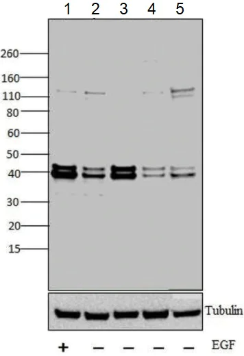 Western blot - Anti-Erk1 (pT202/pY204) + Erk2 (pT185/pY187) antibody (AB4819)