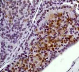 Immunohistochemistry (Formalin/PFA-fixed paraffin-embedded sections) - Anti-Erk1 (pT202/pY204) + Erk2 (pT185/pY187) antibody [E337] - BSA and Azide free (AB232017)